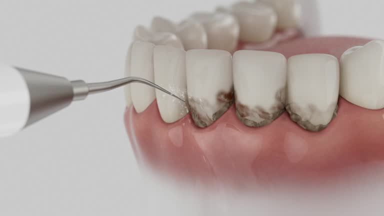 Trusted Teeth Cleaning And Checkup service in Whitehouse, TX - Dentist Open Now